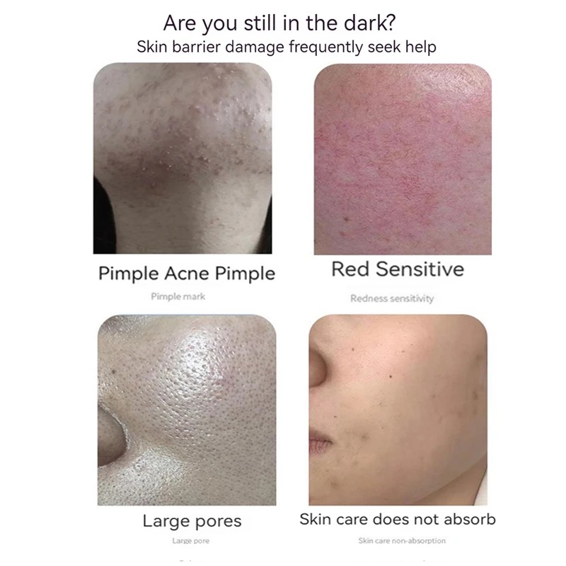 Ensemble de poudre lyophilisée - Oligopeptide Wrinkle avis et prix